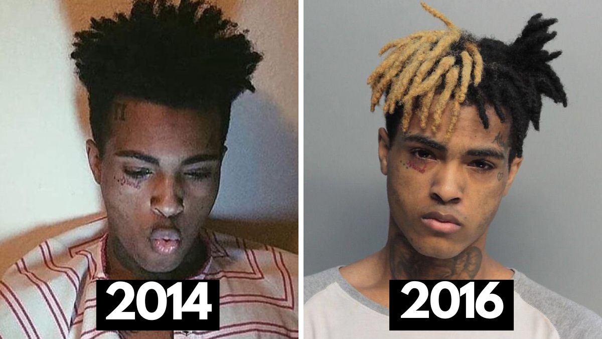 xxxtentacion dreads throughout the years