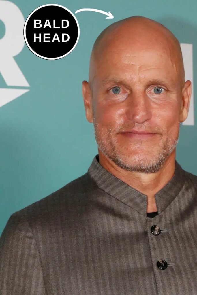 Woody Harrelson with a bald head