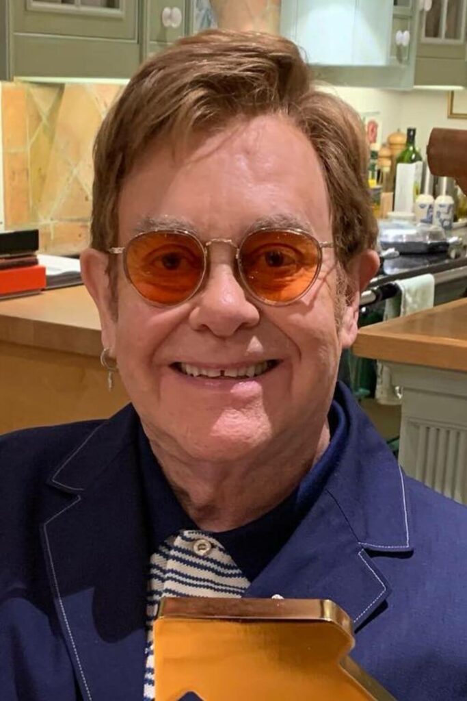 Elton John Hair Today