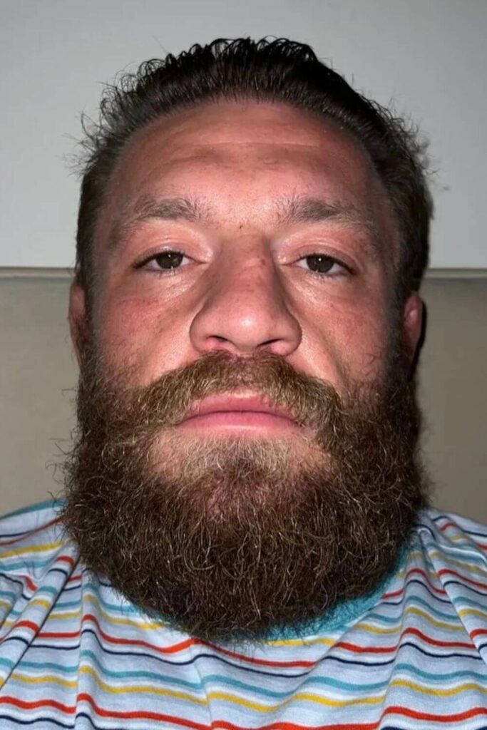 Conor McGregor Beard Bushy and Big
