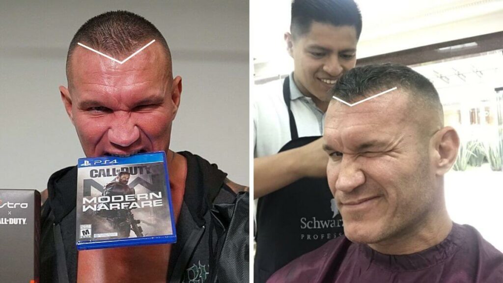 Randy Orton Hair Line