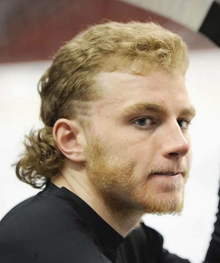Patrick Kane Mullet side view with lines in hair